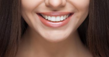 Cele mai performante fatete dentare sunt cele de la dentaline - clinic
